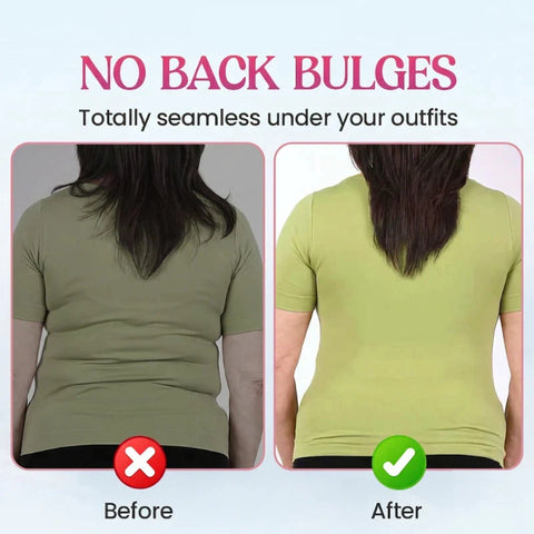 Gentle Support Front Closure Bra